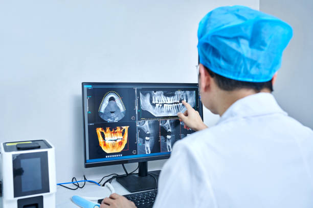 Best Emergency Wisdom Teeth Removal in Dupo, IL